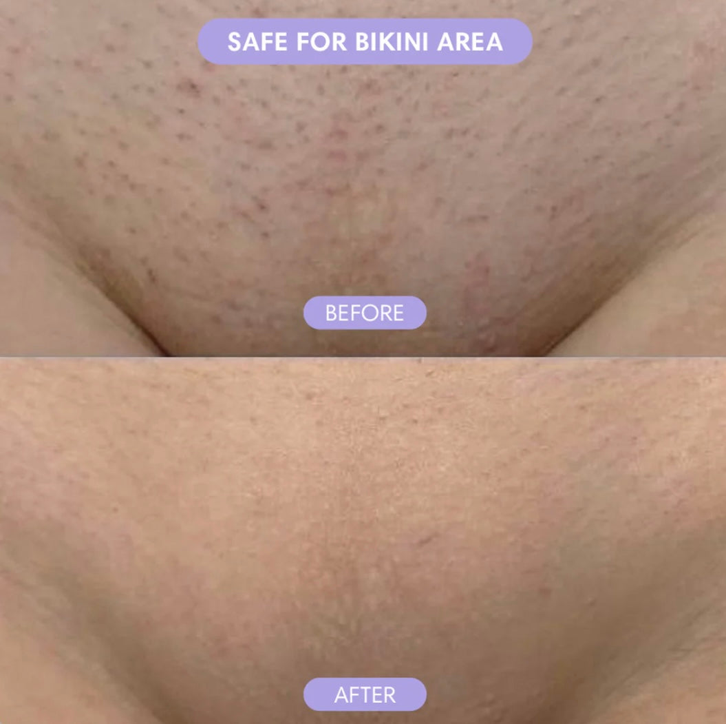 BareBliss Crystal Hair Eraser