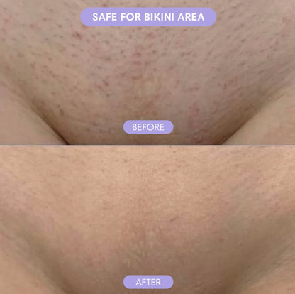 BareBliss Crystal Hair Eraser